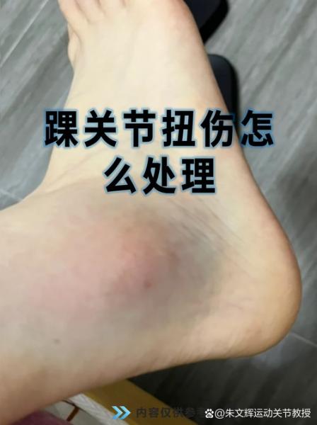 队记：迪恩韦德热身时疑似扭伤了脚踝目前不清楚伤势程度