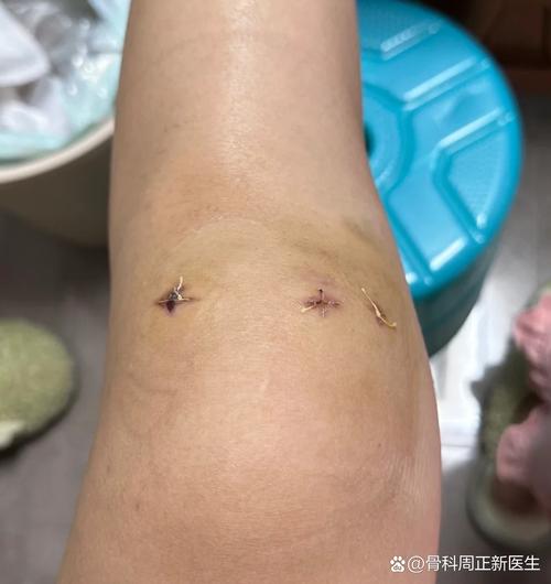 TA：库卢塞夫斯基接受膝关节镜手术，不再为自己设定具体复出时间